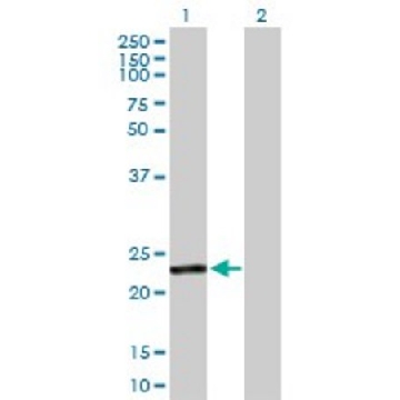 Anti-GSTA4 antibody produced in rabbit，100UG，SAB1401164-100UG，Sigma