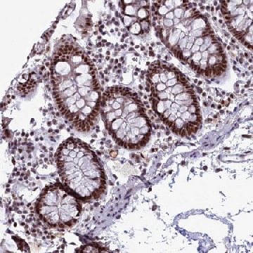 Anti-SF3B3 antibody produced in rabbit，100UL，HPA042986-100UL，Sigma