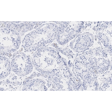 Anti-Pericentrin Antibody, clone 2H11, ZooMAb® Rabbit Monoclonal，4X25UL，ZRB1318-4X25UL，Sigma