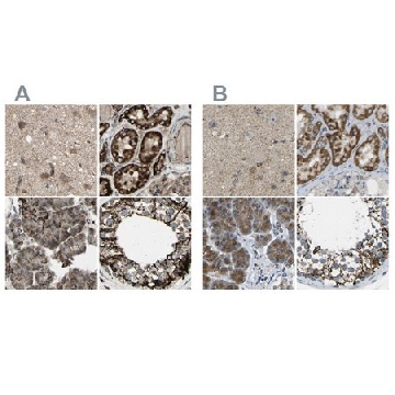 Anti-CYB5R1 antibody produced in rabbit，100UL，HPA010641-100UL，Sigma