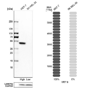 Anti-KRT18 antibody produced in rabbit，100UL，HPA001605-100UL，Sigma