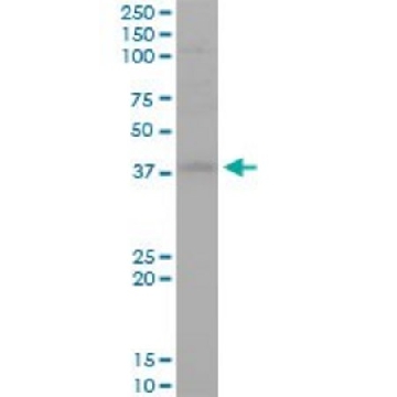 Monoclonal Anti-STYK1 antibody produced in mouse，100UG，SAB1405150-100UG，Sigma