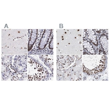 Anti-SF3A1 antibody produced in rabbit，100UL，HPA000690-100UL，Sigma