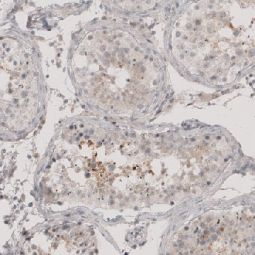Anti-CT83 antibody produced in rabbit，100UL，HPA004773-100UL，Sigma