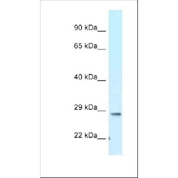 Anti-TMEM106B antibody produced in rabbit，100UL，SAB2106773-100UL，Sigma