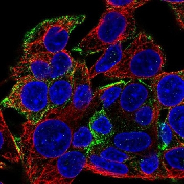Anti-KANK1 antibody produced in rabbit，100UL，HPA056090-100UL，Sigma
