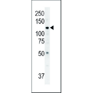 ANTI-ATP13A3 (N-TERM) antibody produced in rabbit，400UL，SAB1302984-400UL，Sigma