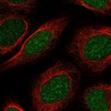 Anti-PAPOLB antibody produced in rabbit，100UL，HPA047285-100UL，Sigma
