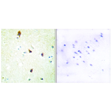 Anti-5-HT-2B antibody produced in rabbit，100UG，SAB4501475-100UG，Sigma