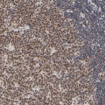 Anti-EP300 antibody produced in rabbit，100UL，HPA004112-100UL，Sigma