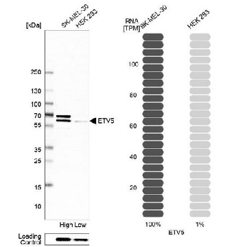 Anti-ETV5 antibody produced in rabbit，100UL，HPA063065-100UL，Sigma