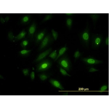 Monoclonal Anti-NEK10 antibody produced in mouse，100UG，WH0152110M1-100UG，Sigma