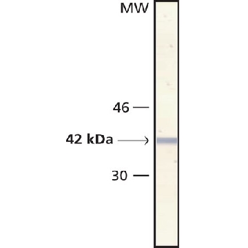 抗-肌动蛋白，α-平滑肌-碱性磷酸酶抗体，小鼠单克隆，0.2ML，A5691-.2ML，Sigma