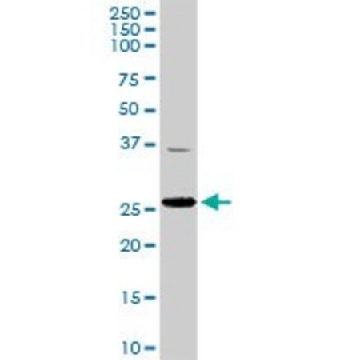 Anti-TFAM antibody produced in rabbit，100UG，SAB1401383-100UG，Sigma