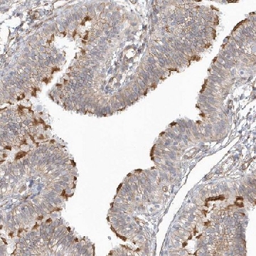 Anti-DNAH1 antibody produced in rabbit，100UL，HPA036806-100UL，Sigma