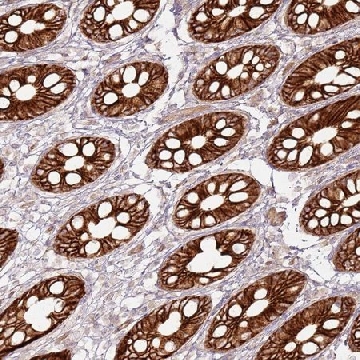 Anti-TLDC2 antibody produced in rabbit，100UL，HPA047468-100UL，Sigma