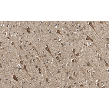 Anti-TPH-1 Antibody, clone 3J7 ZooMAb® Rabbit Monoclonal，25UL，ZRB1305-25UL，Sigma