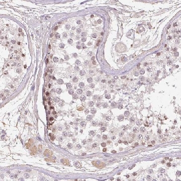 Anti-TDRD15 antibody produced in rabbit，100UL，HPA051770-100UL，Sigma