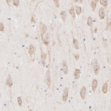 Anti-AFF2 antibody produced in rabbit，100UL，HPA003139-100UL，Sigma