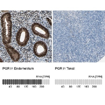 Anti-PGR antibody produced in rabbit，100UL，HPA008428-100UL，Sigma