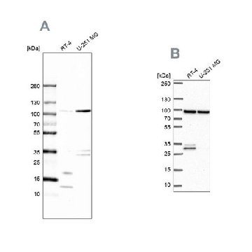 Anti-WDR48 antibody produced in rabbit，100UL，HPA038421-100UL，Sigma