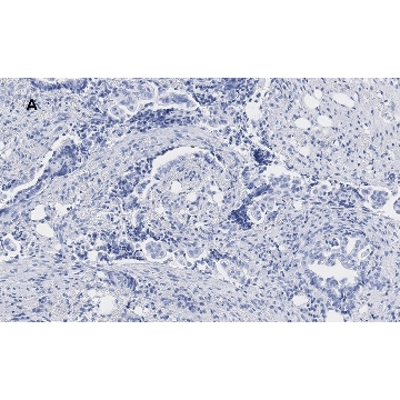 Anti-phospho JNK (Thr183, Tyr185) Antibody, clone 3F7, ZooMAb® Rabbit Monoclonal，4X25UL，ZRB1173-4X25UL，Sigma