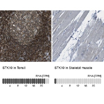 Anti-STK10 antibody produced in rabbit，100UL，HPA015083-100UL，Sigma