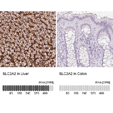 Anti-SLC2A2 antibody produced in rabbit，100UL，HPA028997-100UL，Sigma