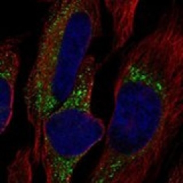 Anti-COL7A1 antibody produced in rabbit，100UL，HPA018877-100UL，Sigma