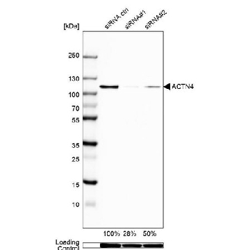 Anti-ACTN4 antibody produced in rabbit，100UL，HPA001873-100UL，Sigma