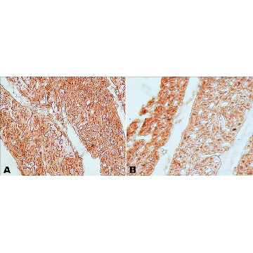 Anti-Guanylyl Cyclase α1 antibody produced in rabbit，0.2ML，G4280-.2ML，Sigma