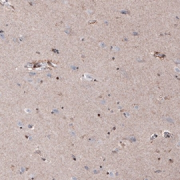 Monoclonal Anti-SOX10 antibody produced in mouse，100UL，AMAB91297-100UL，Sigma