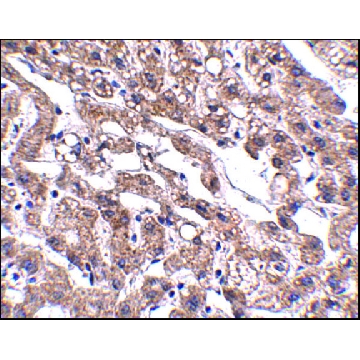 Anti-MACC1 antibody produced in rabbit，100UG，SAB3500273-100UG，Sigma