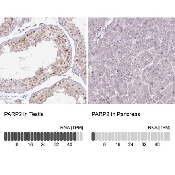 抗-PARP2 兔抗，100UL，HPA052003-100UL，Sigma