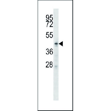 ANTI-ZDHHC6 (C-TERM) antibody produced in rabbit，400UL，SAB1304457-400UL，Sigma