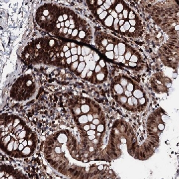 Anti-KIF18A antibody produced in rabbit，100UL，HPA039484-100UL，Sigma