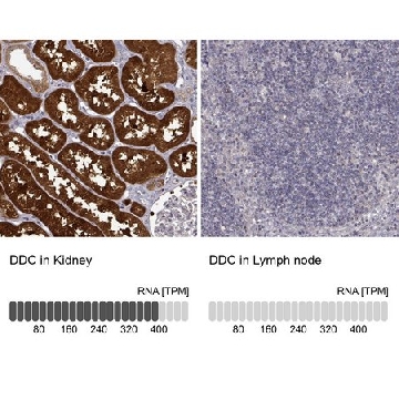 Anti-DDC antibody produced in rabbit，100UL，HPA017742-100UL，Sigma