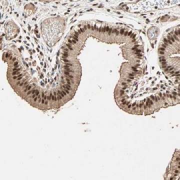 Anti-ZBTB33 antibody produced in rabbit，100UL，HPA005732-100UL，Sigma