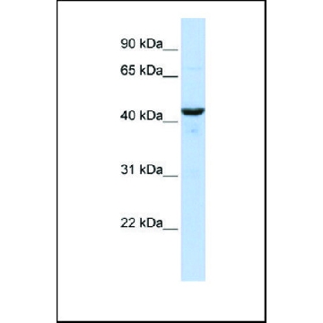 Anti-RNH1 antibody produced in rabbit，100UL，SAB2103139-100UL，Sigma