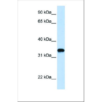 Anti-HAS3 (ab2) antibody produced in rabbit，100UL，SAB2101015-100UL，Sigma