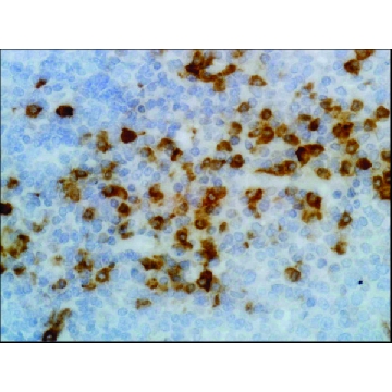 Anti-Human Kappa Light Chain antibody, Rabbit monoclonal，100UG，SAB5600219-100UG，Sigma