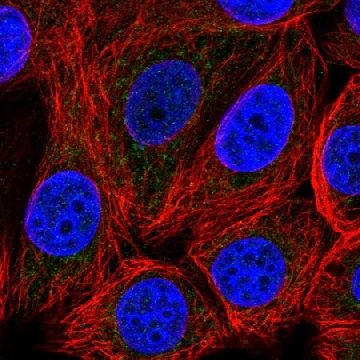 Anti-SLC25A51 antibody produced in rabbit，100UL，HPA046388-100UL，Sigma