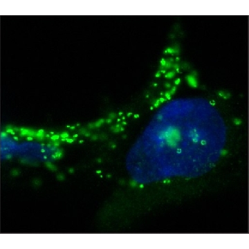 Anti-ADFP / PLIN2 antibody, Mouse monoclonal，200UL，SAB4200452-200UL，Sigma