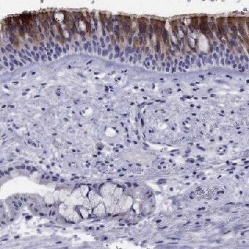 Anti-CDHR3 antibody produced in rabbit，100UL，HPA011218-100UL，Sigma