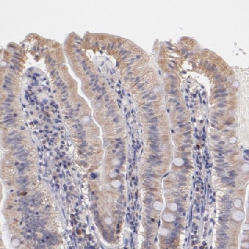 Anti-RNASEL antibody produced in rabbit，100UL，HPA002633-100UL，Sigma