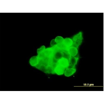 Anti-CX3CR1 antibody produced in mouse，50UG，SAB1405682-50UG，Sigma