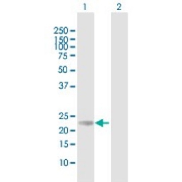 Anti-RS1 antibody produced in mouse，50UG，SAB1401345-50UG，Sigma
