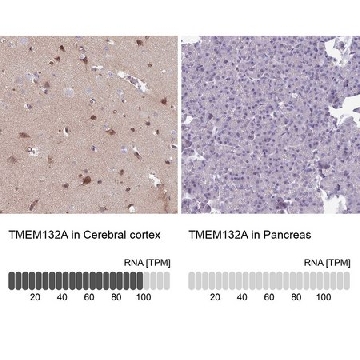 Anti-TMEM132A antibody produced in rabbit，100UL，HPA051979-100UL，Sigma