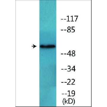 Anti-phospho-FRS2 (pTyr⁴³⁶) antibody produced in rabbit，100UG，SAB4504670-100UG，Sigma
