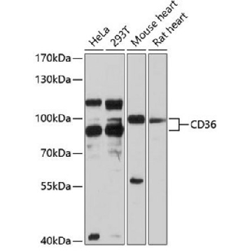 Anti-CD36 antibody produced in rabbit，100UL，SAB5700741-100UL，Sigma